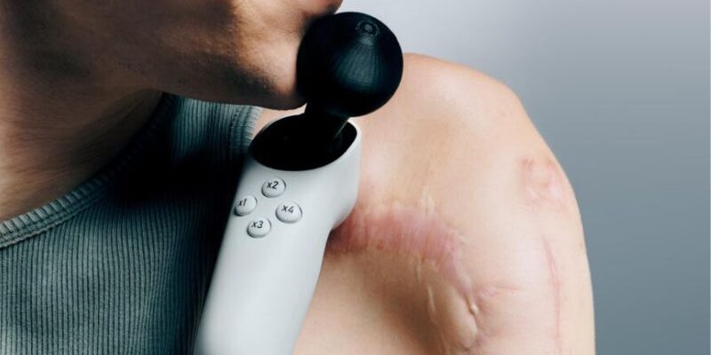 OnData-Xbox-Inclusión